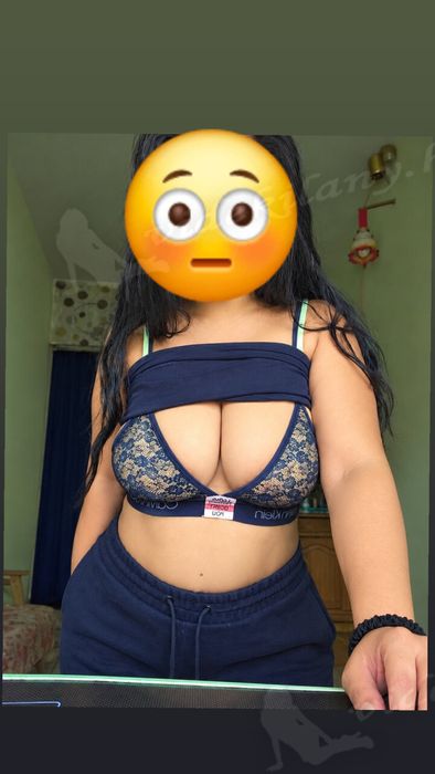 OG Image